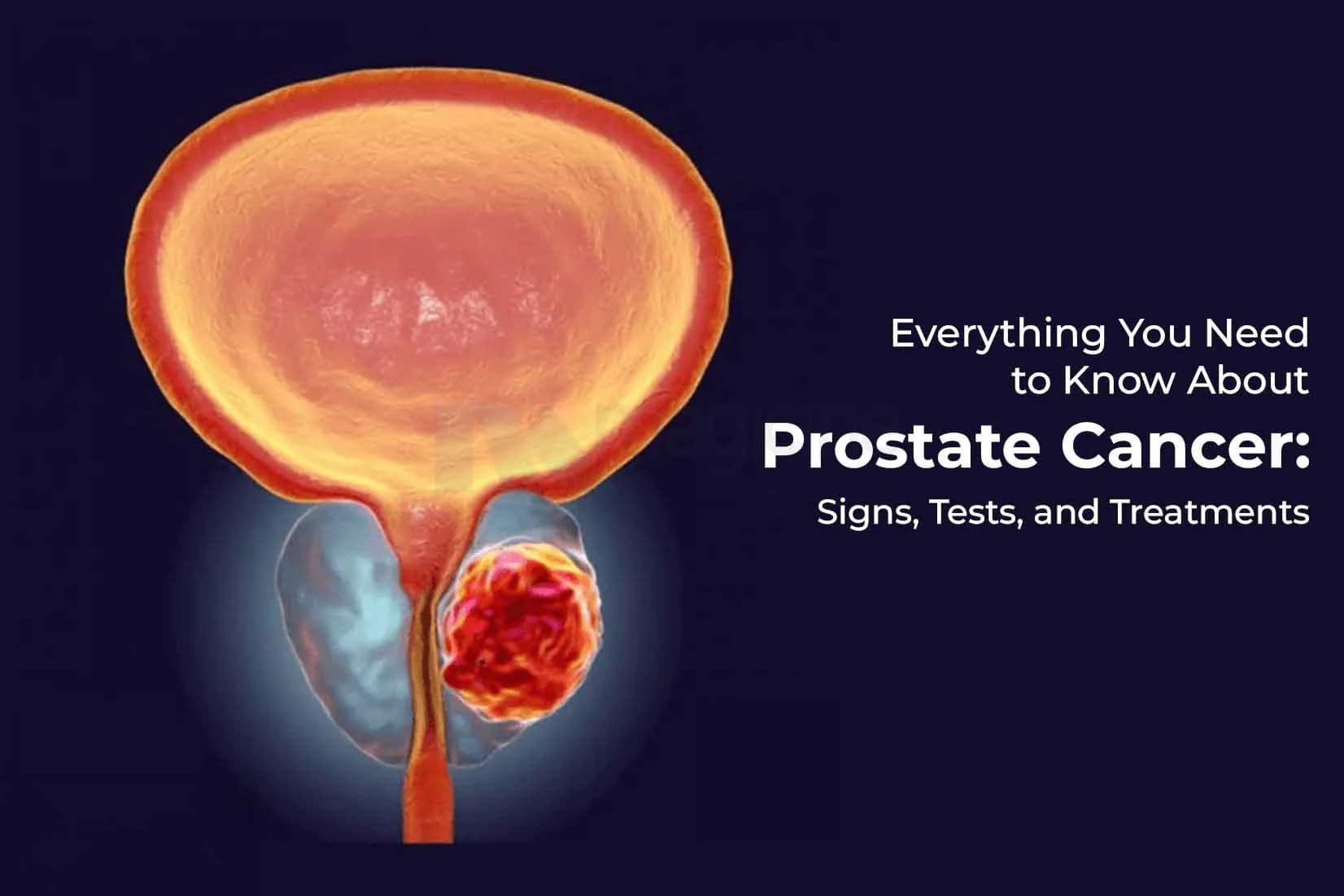 Everything You Need to Know About Prostate Cancer: Signs, Tests, and Treatments