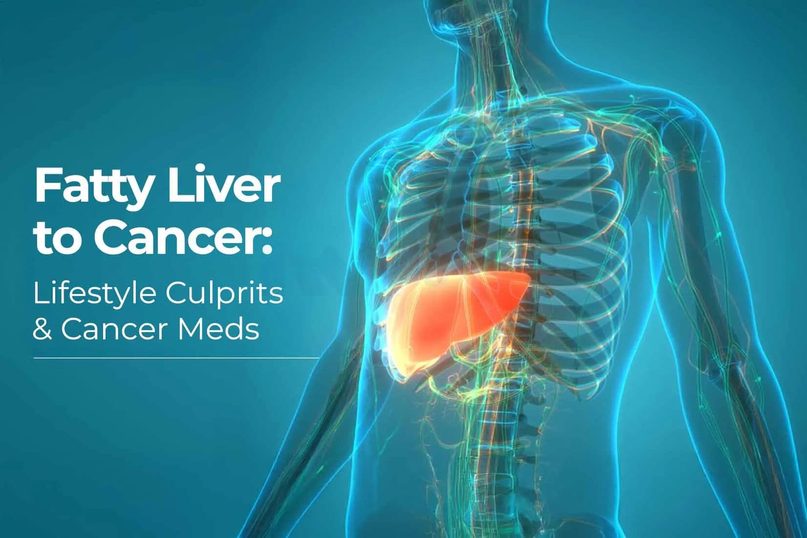Fatty Liver to Cancer: Lifestyle Culprits and Cancer Meds